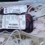 Ape-to-human, pig-to-human blood donations: Could xenotransfusions work?
